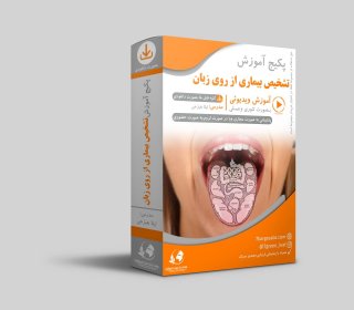 اموزش تشخیص بیماری از روی زبان
