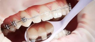 ارتودنسی دندان؛ راهکاری اصولی برای لبخندی زیباتر